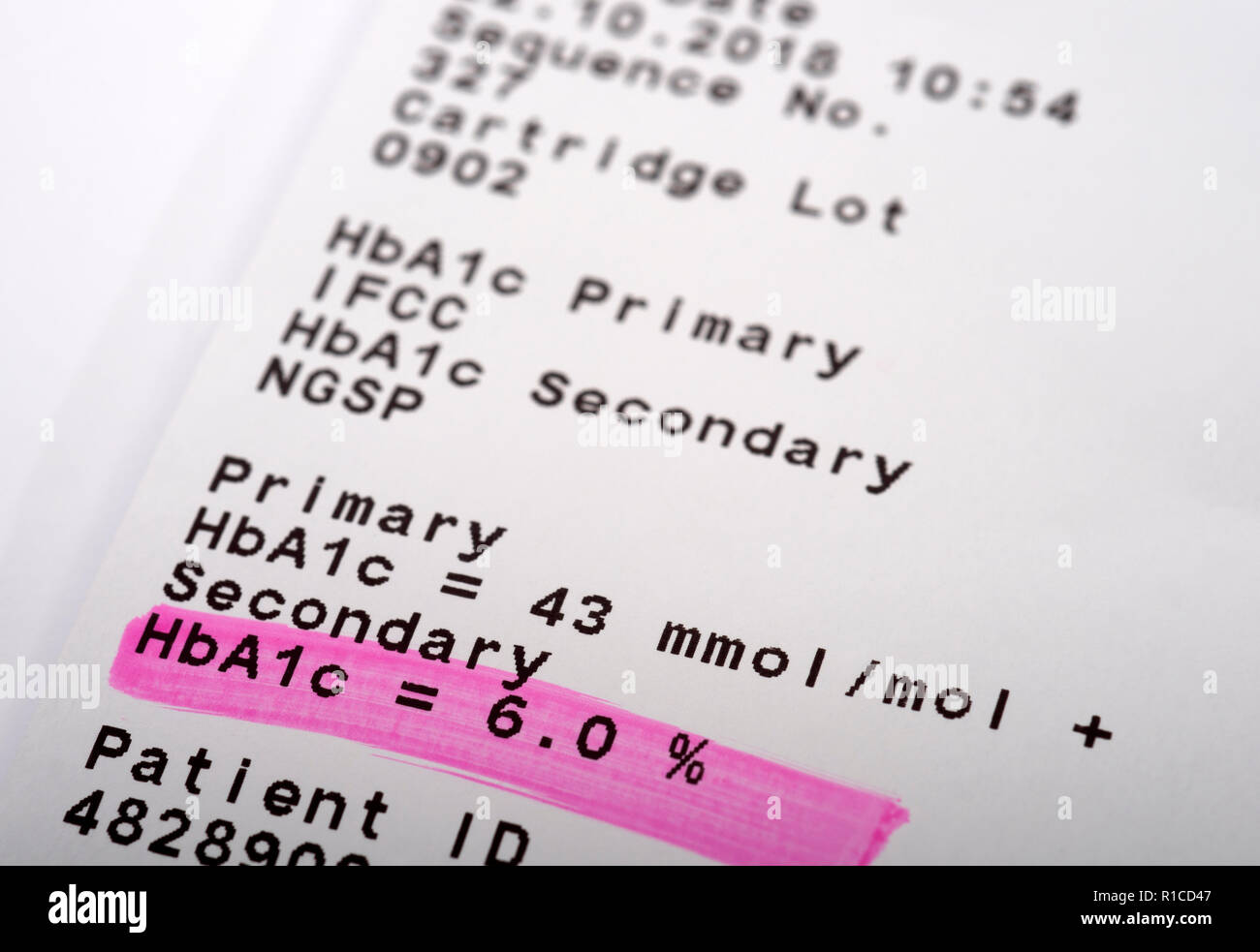 HbA1c lecture de glucose de sang Banque D'Images