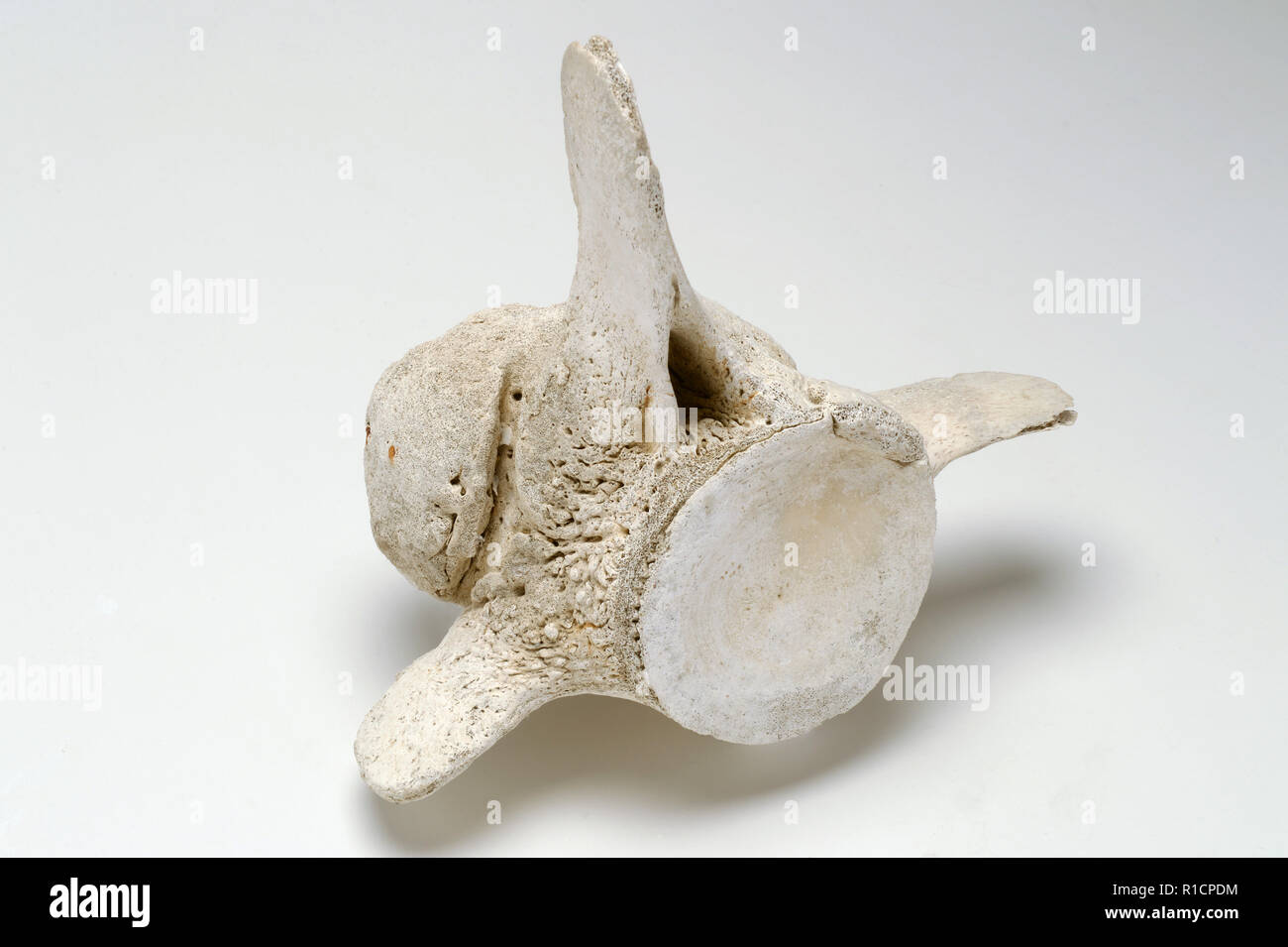 Vertèbre de baleine à l'ancienne blessure harpon comme une croissance osseuse calcifiée où la lame se brisa. Témoigne de l'intensité de la chasse à la 19e C Banque D'Images Vertèbre de baleine à l'ancienne blessure harpon comme une croissance osseuse calcifiée où la lame se brisa. Témoigne de l'intensité de la chasse à la 19e C Banque D'Images