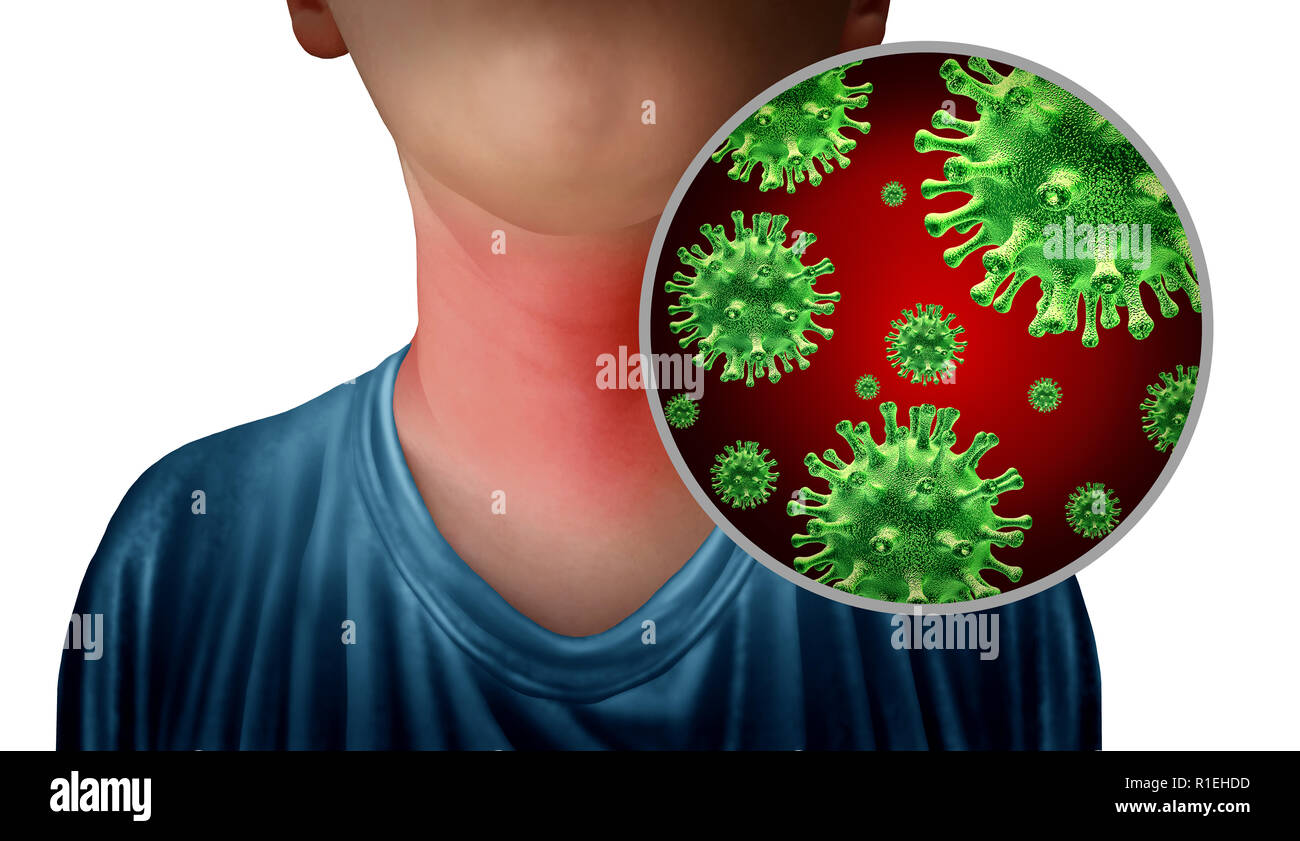 Mal de gorge comme une infection à germe microscopique du cou anatomie close up comme un symbole pour la grippe ou l'influenza maladie avec illustrations 3D. Banque D'Images