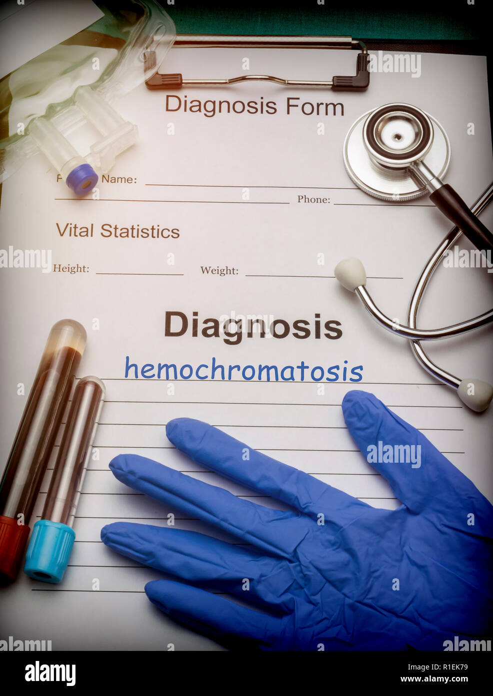 Diagnostic médical hémochromatose, conceptual image Banque D'Images