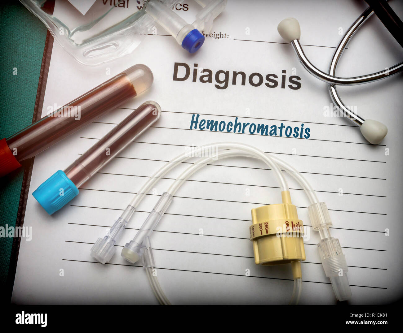 Diagnostic médical hémochromatose, conceptual image Banque D'Images