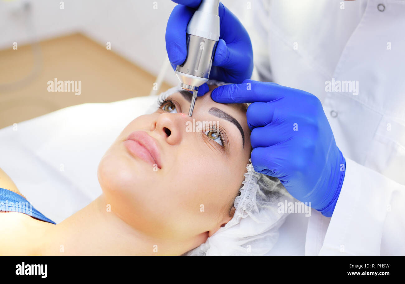 Le chirurgien enlève la pigmentation et coiffeur filets vasculaires sur la peau du patient-une belle jeune femme laser néodyme. Cosmétologie Laser Banque D'Images