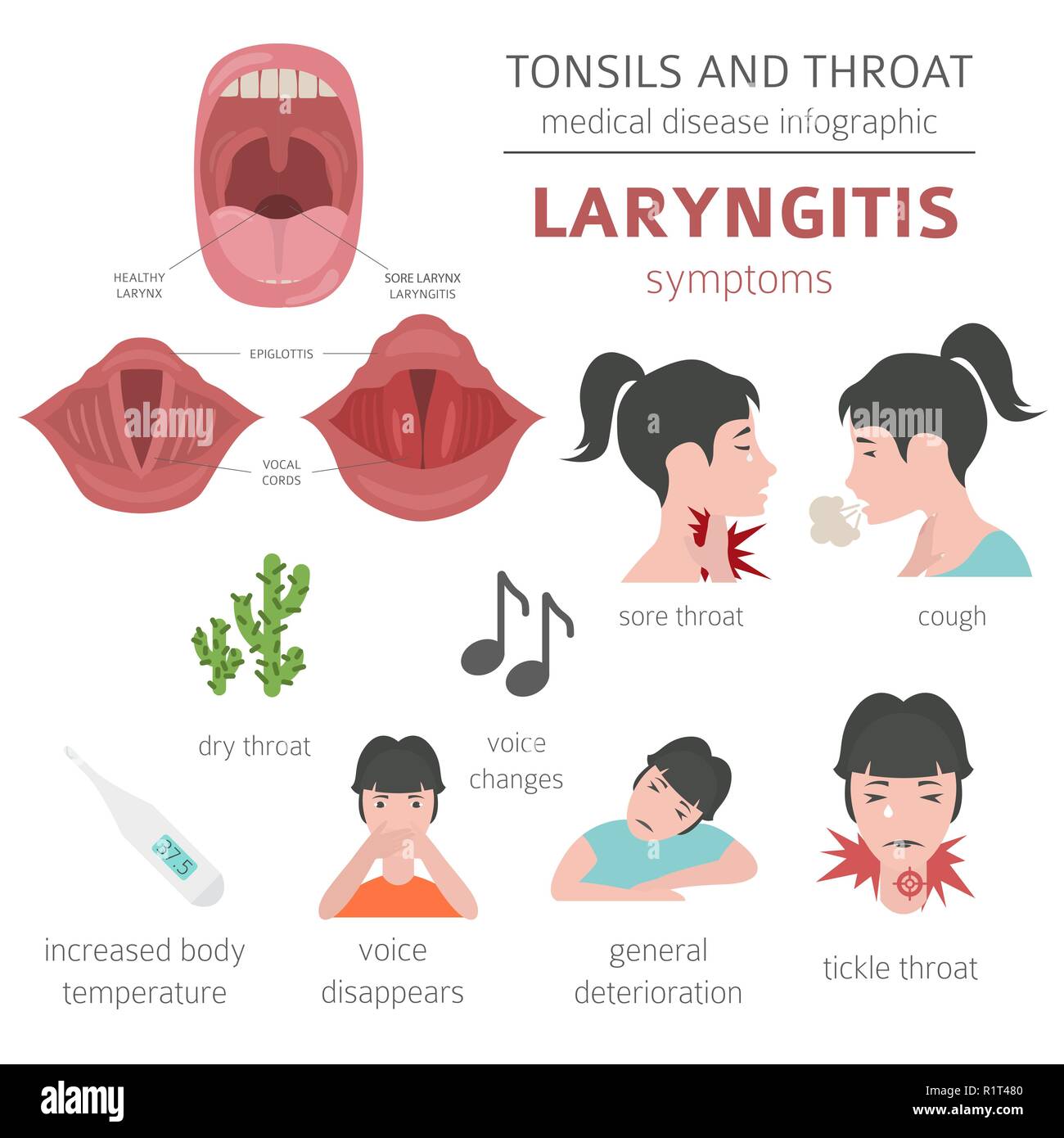 Amygdales et de la gorge. Les symptômes de la laryngite, l'icône de traitement défini. Conception infographique médical. Vector illustration Illustration de Vecteur