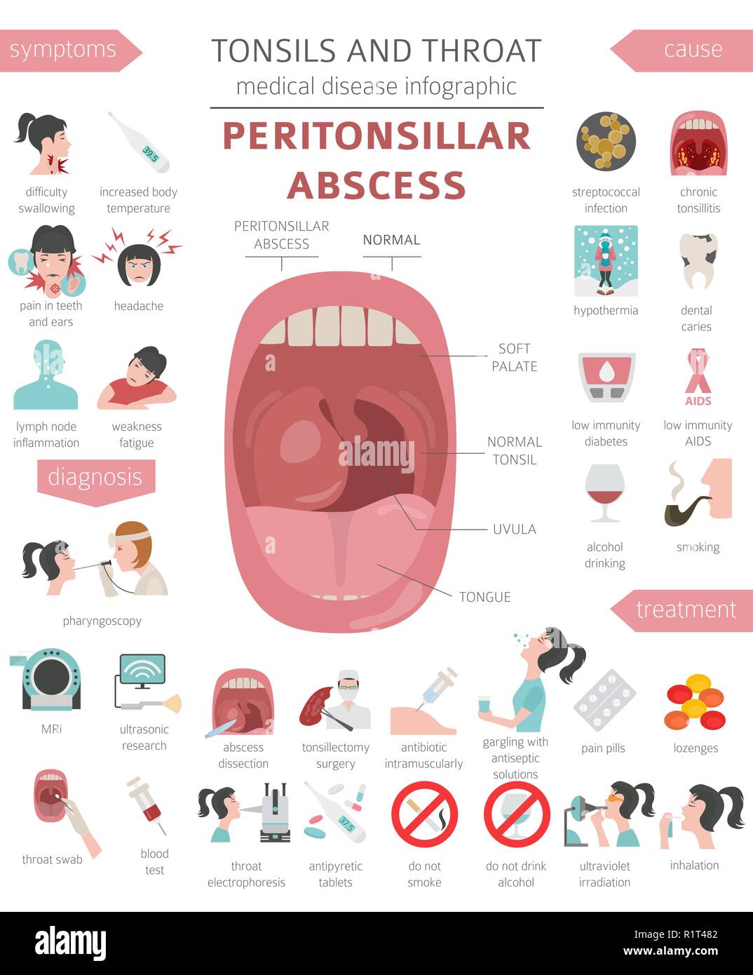 Amygdales Et De La Gorge Abces Periamygdalien Symptomes Traitement Icon Set Conception Infographique Medical Vector Illustration Image Vectorielle Stock Alamy