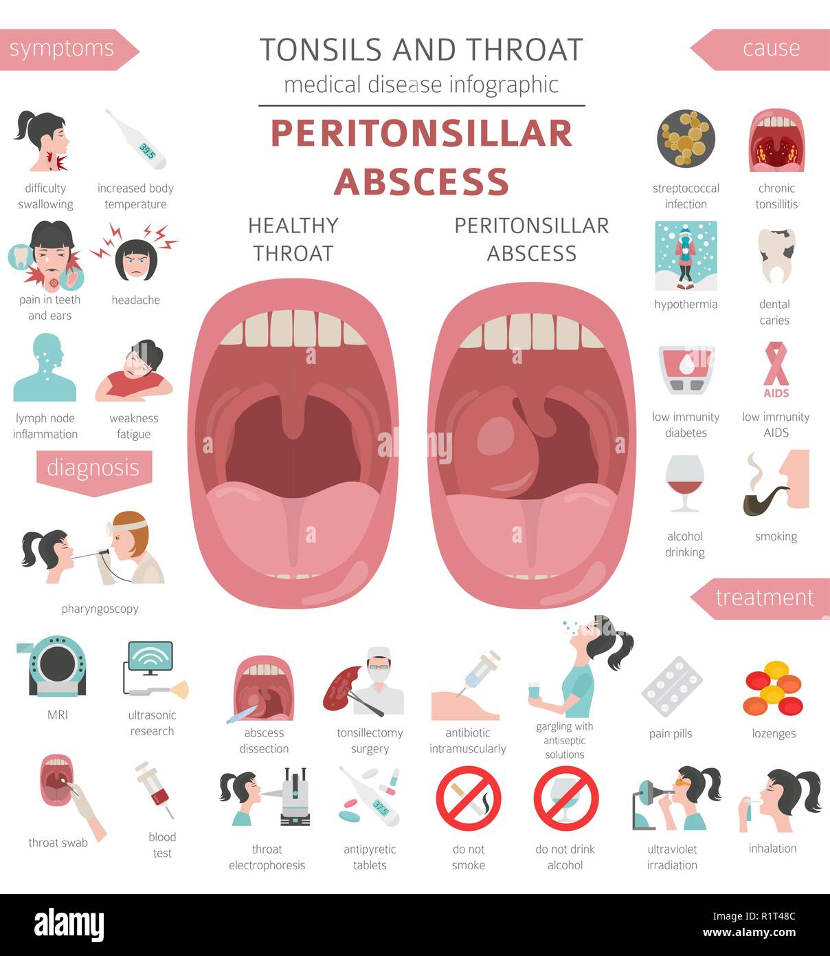 Amygdales Et De La Gorge Abces Periamygdalien Symptomes Traitement Icon Set Conception Infographique Medical Vector Illustration Image Vectorielle Stock Alamy