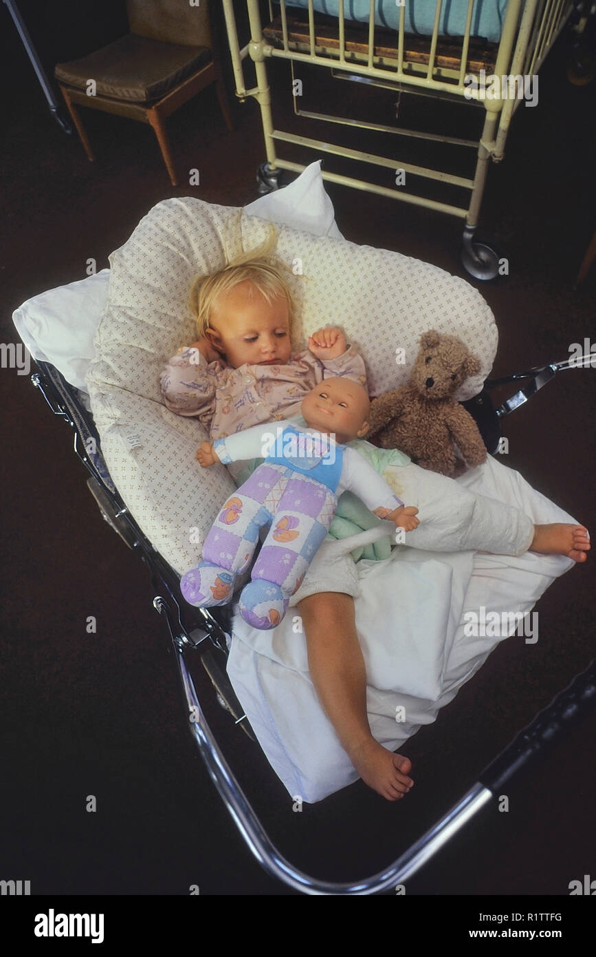 Un enfant avec un plâtre après une opération de la luxation congénitale de la hanche, England, UK Banque D'Images