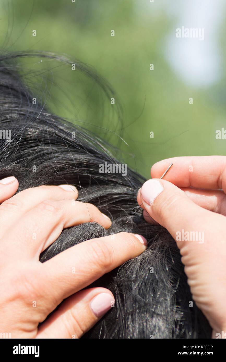 L'acupuncture. L'insertion d'aiguille dans la peau d'un cheval. Allemagne Banque D'Images