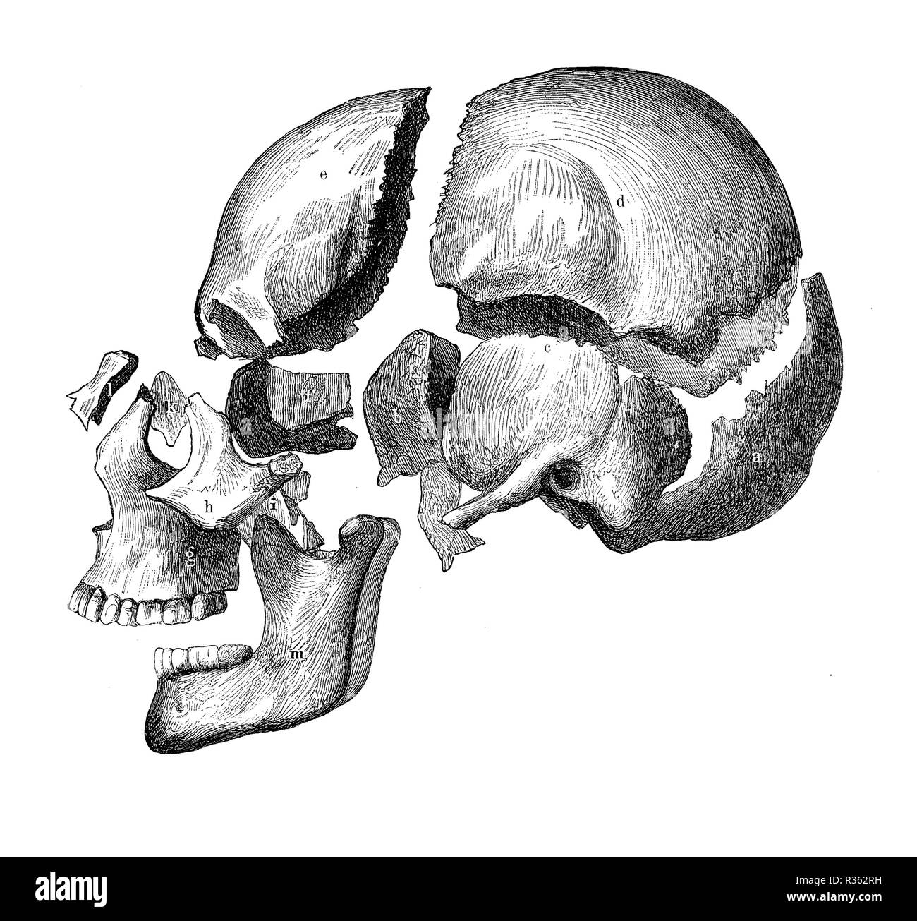 Vintage illustration de l'anatomie, le crâne avec la mâchoire et des dents, des os sur la décomposition Banque D'Images