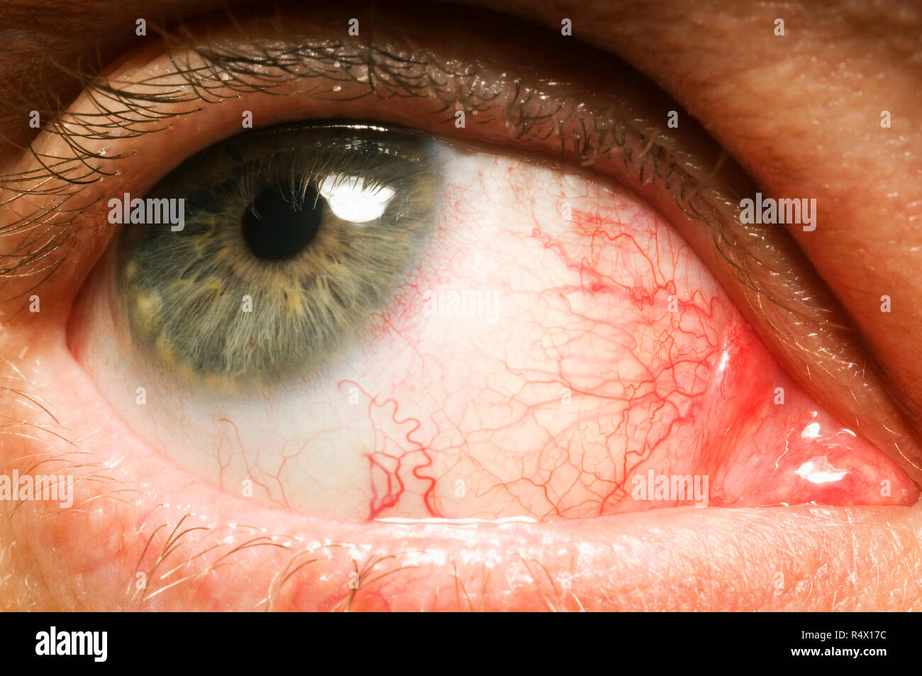 Un gros plan d'un des yeux injectés de sang Banque D'Images