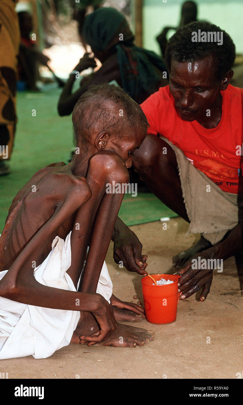1993 - un enfant réfugié somalien est alimenté à un poste de secours mis en place lors de l'Opération Restore Hope les efforts de secours. Bardera (Somalie) Banque D'Images