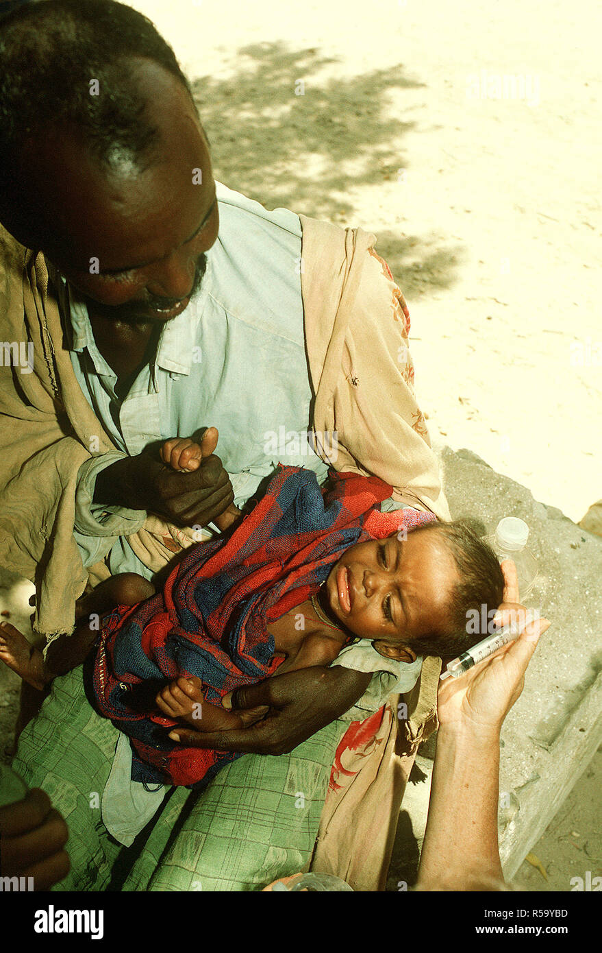 1993 - Un réfugié somalien l'enfant pleure après avoir été donné de l'eau au moyen d'une seringue à un poste de secours mis en place lors de l'Opération Restore Hope les efforts de secours. Bardera (Somalie) Banque D'Images