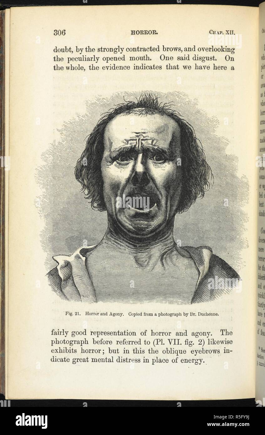 L'horreur et de l'agonie. Illustration dans 'l'expression des émotions chez l'homme et les animaux'. Copié à partir d'une photo par le Dr Langlois. L'expression des émotions chez l'homme et les animaux. Londres, 1873. Source : 7005.df.6, page 306. Auteur : Darwin, Charles. Banque D'Images