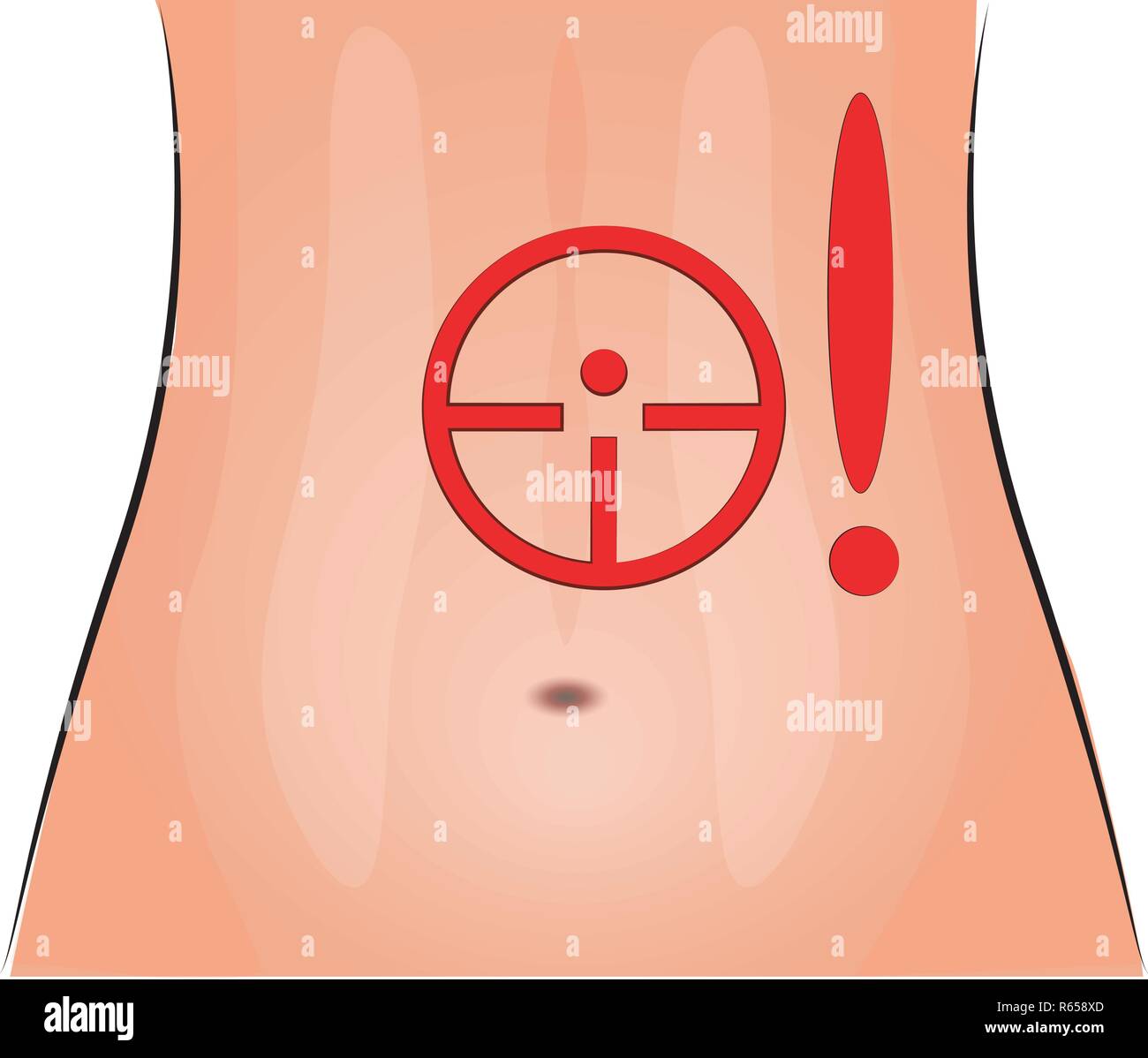 Illustration de la douleur d'estomac. estomac. ballonnements. Ulcère  gastroduodénal Image Vectorielle Stock - Alamy