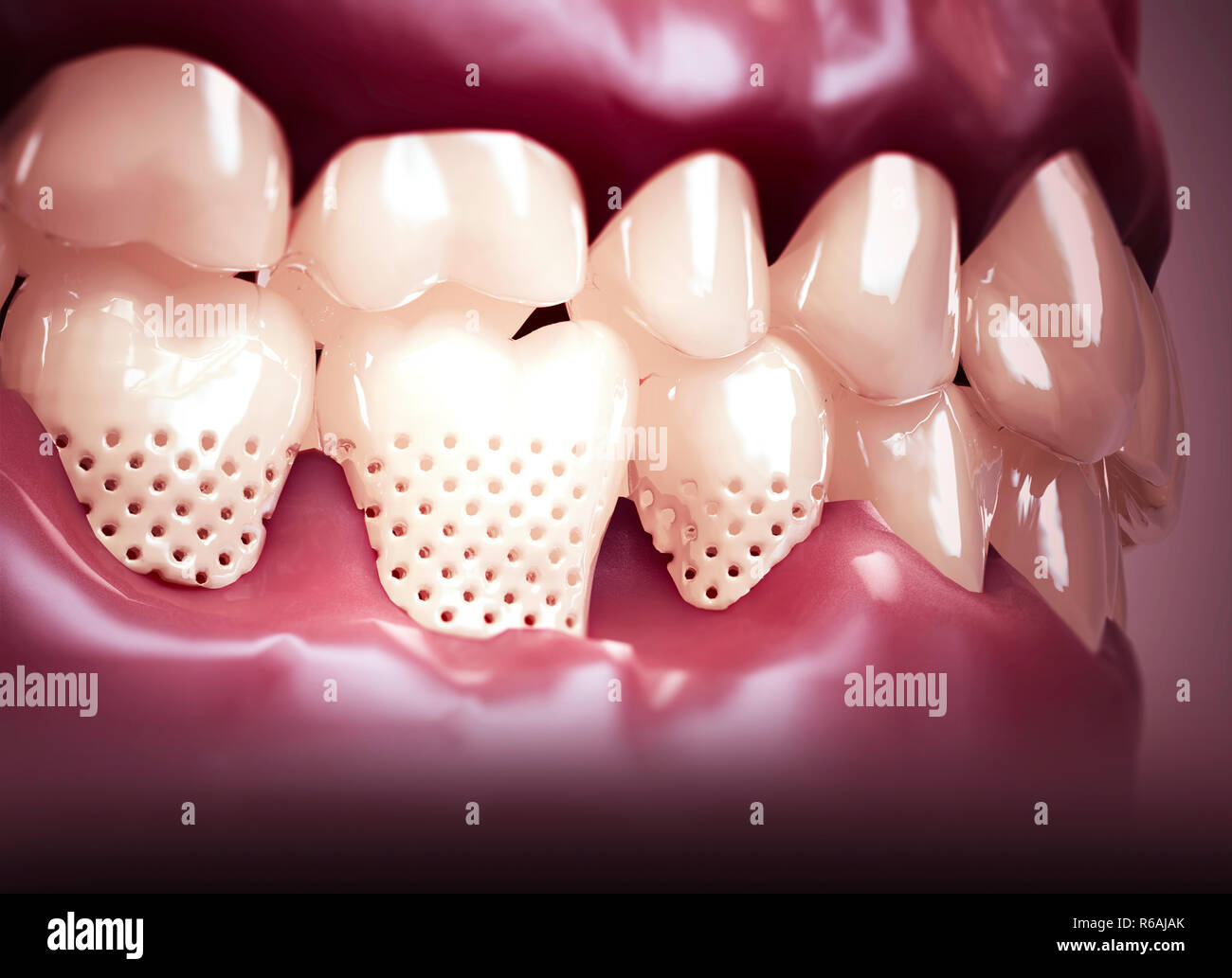 La bouche, des dents, des gencives. Dents sensibles, retrait de la gencive. La sensibilité dentaire. Laboratoire dentaire. Le rendu 3D Banque D'Images