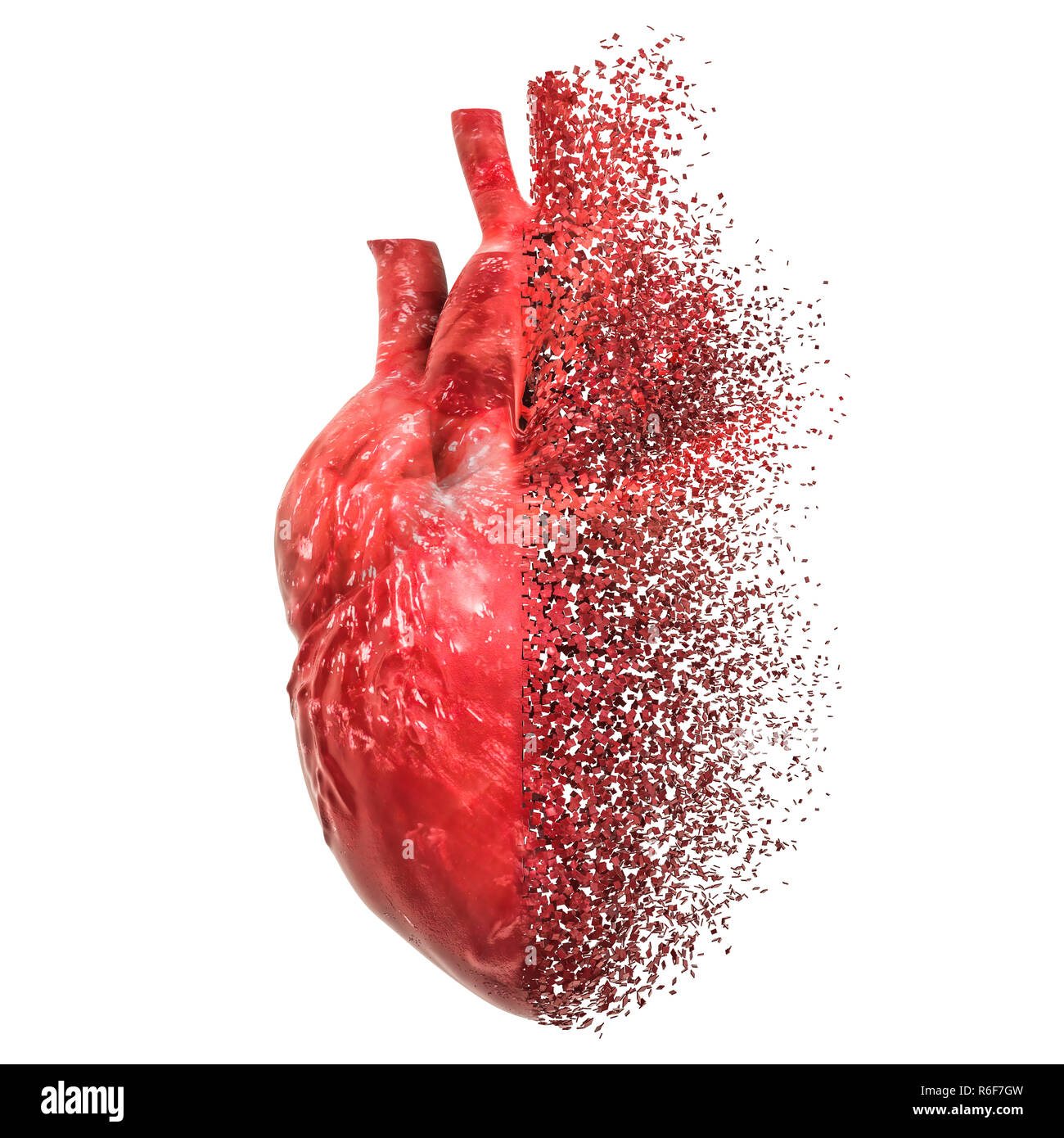 La maladie cardiaque concept. Le rendu 3D isolé sur fond blanc Banque D'Images