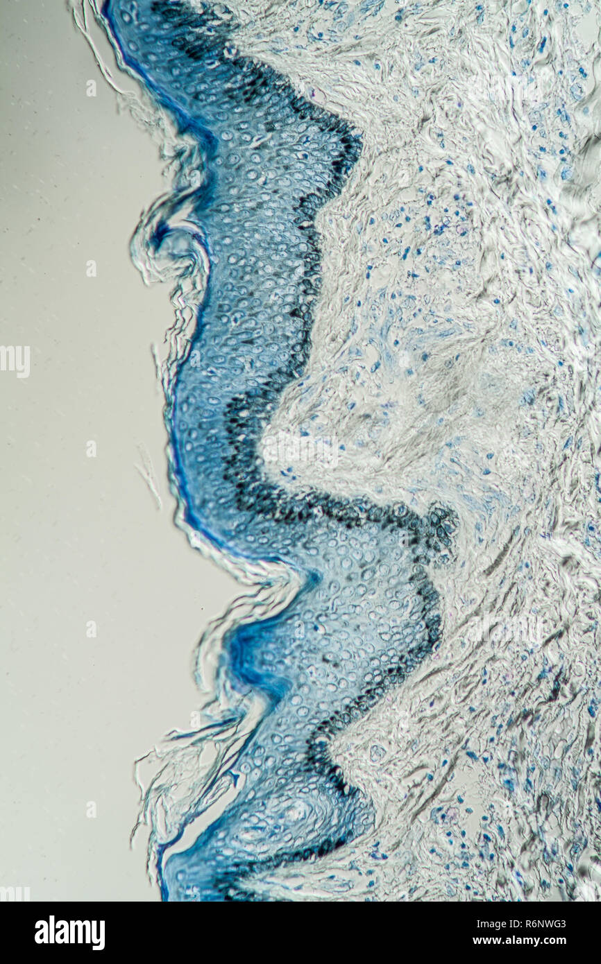 La lèpre sous le microscope Banque D'Images
