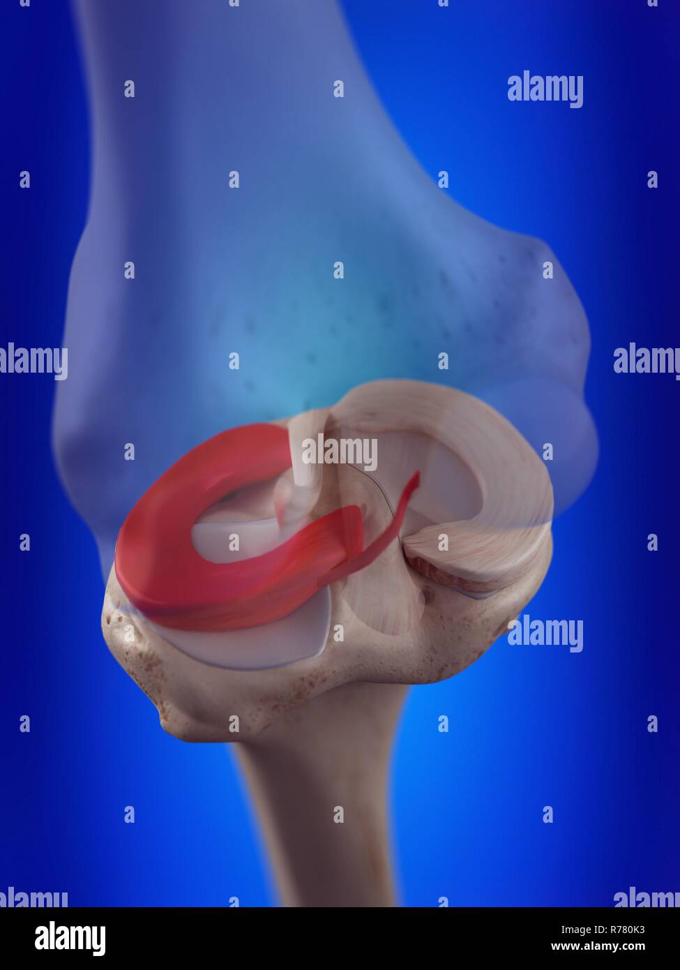 Rendu 3d illustration du ménisque externe. Banque D'Images