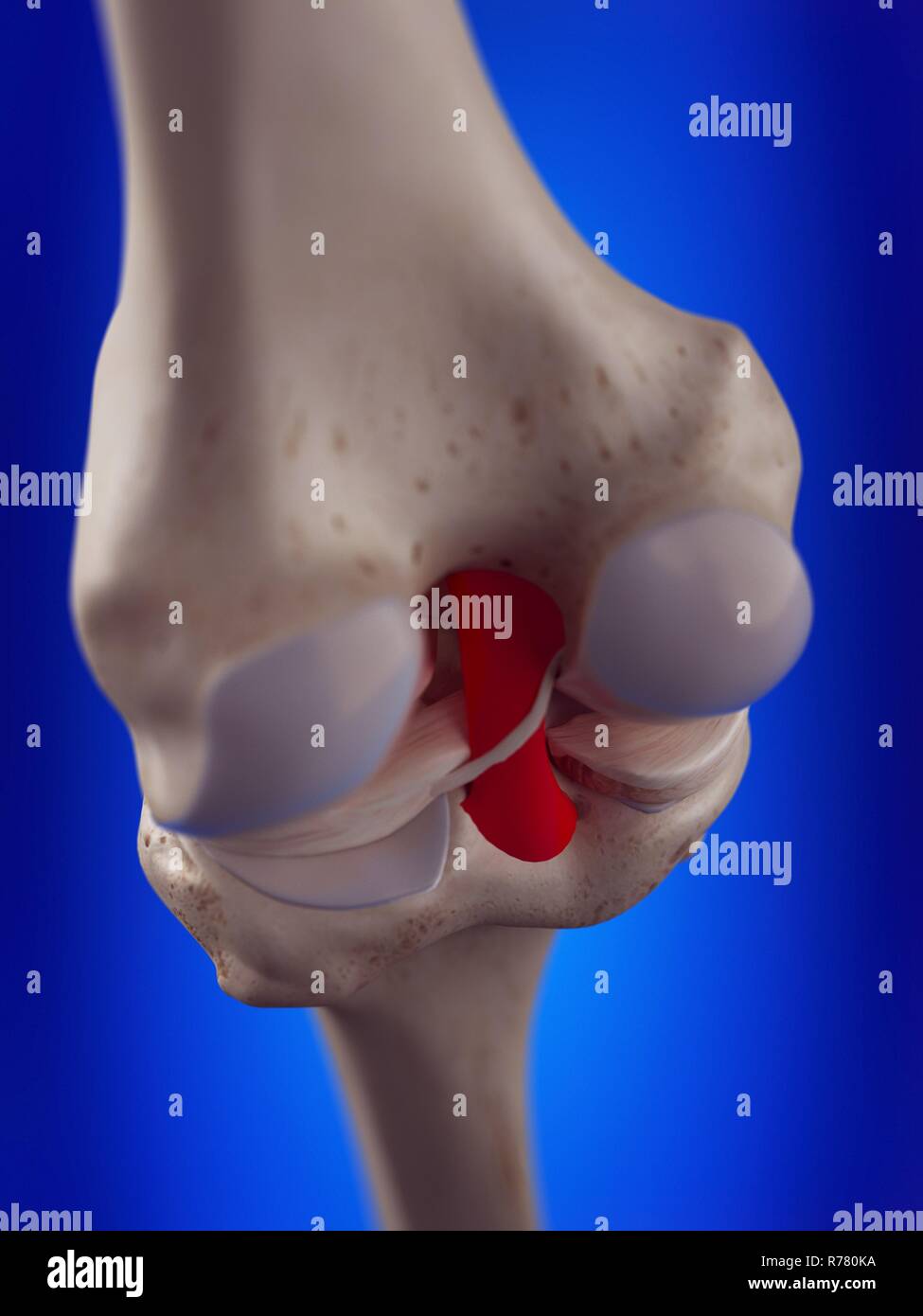 Rendu 3d illustration du ligament croisé postérieur. Banque D'Images