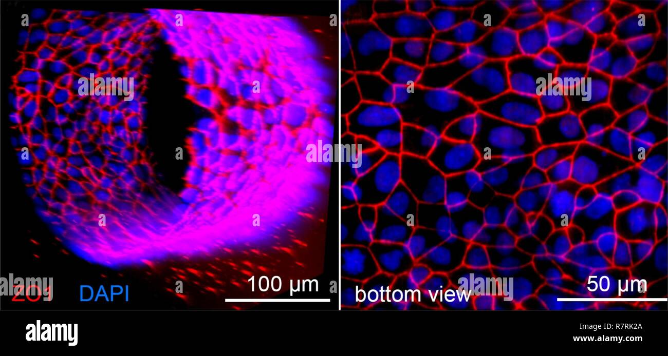 Image d'un microscope confocal origine tissulaire des microvaisseaux formés à partir de cellules endothéliales microvasculaires du cerveau humain dans une matrice 3D. Banque D'Images