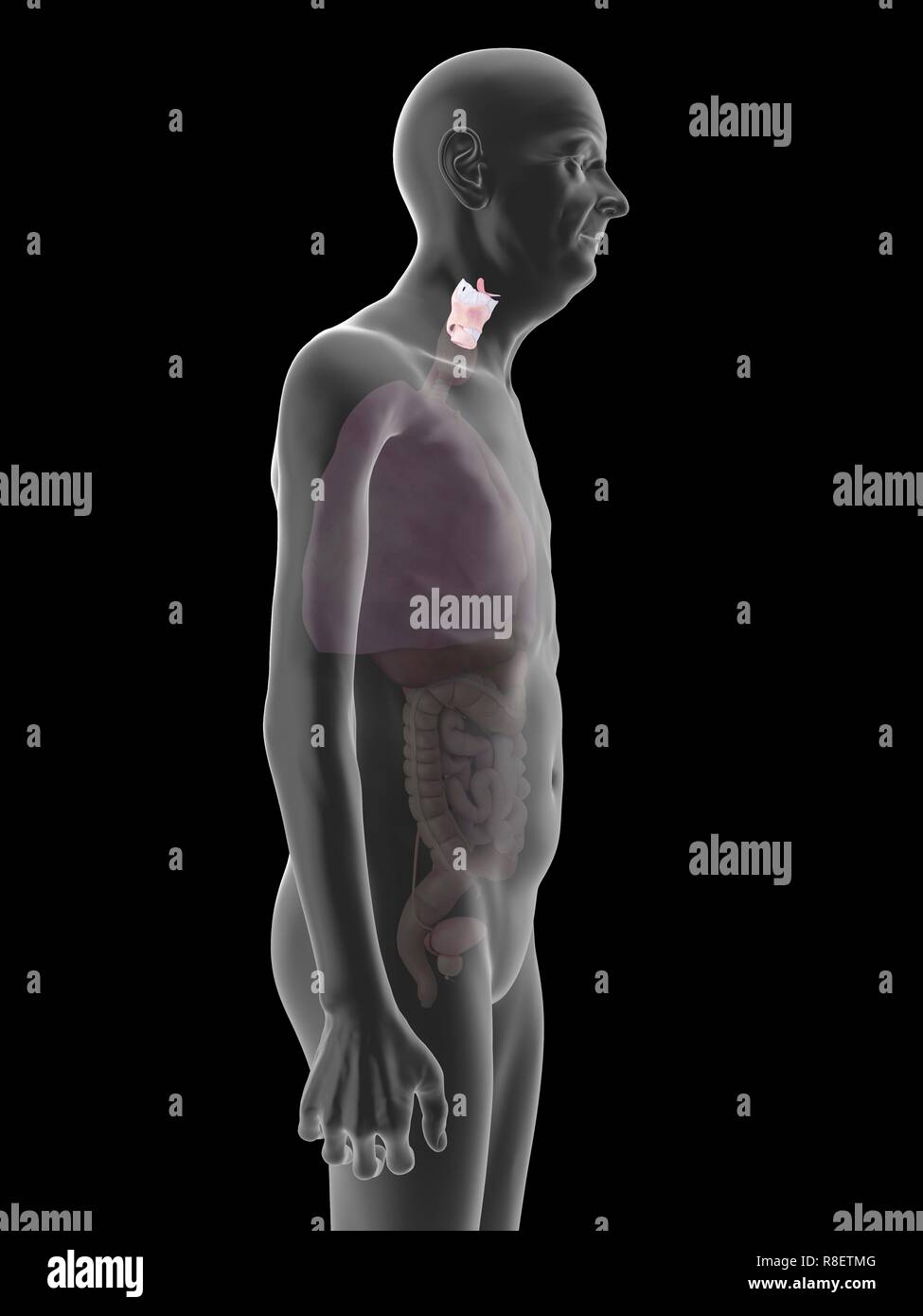 Illustration d'un vieil homme, du larynx. Banque D'Images