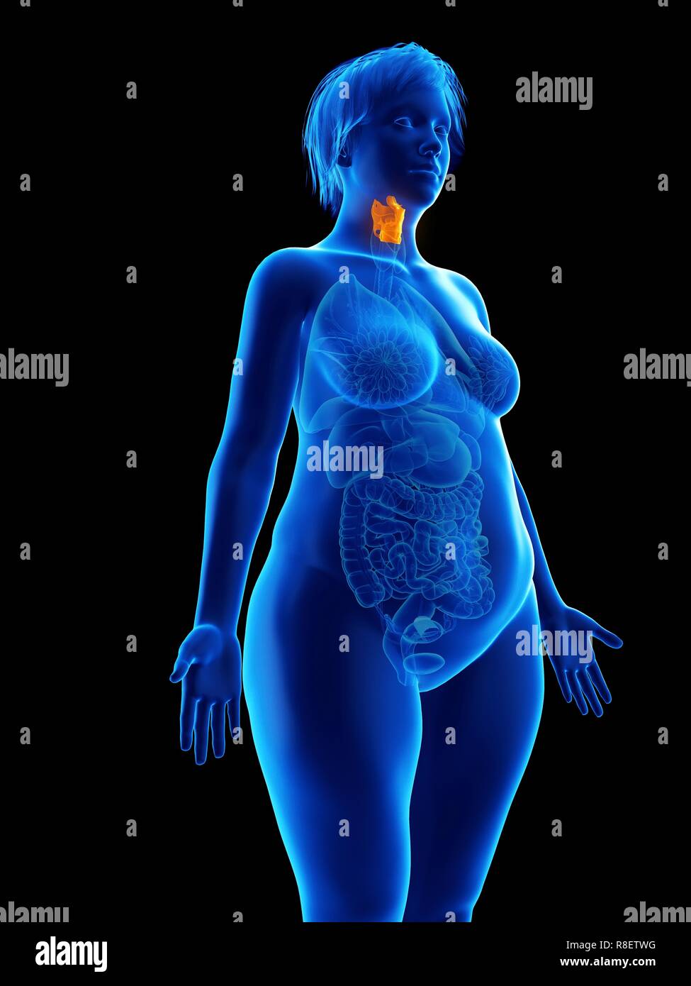 Illustration d'une femme obèse du larynx. Banque D'Images