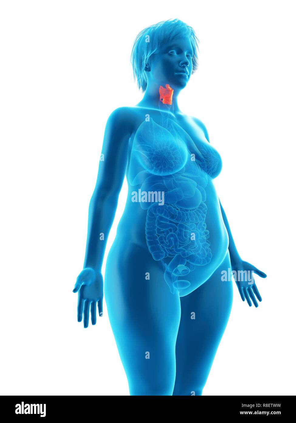 Illustration d'une femme obèse du larynx. Banque D'Images