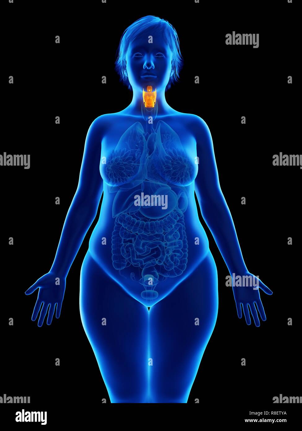 Illustration d'une femme obèse du larynx. Banque D'Images