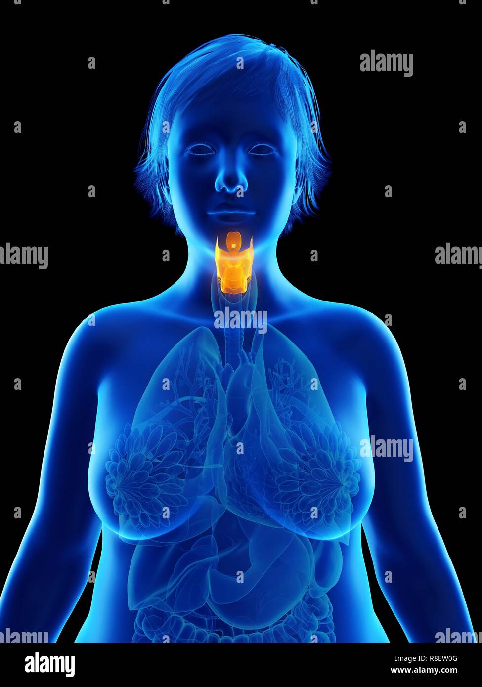 Illustration d'une femme obèse du larynx. Banque D'Images
