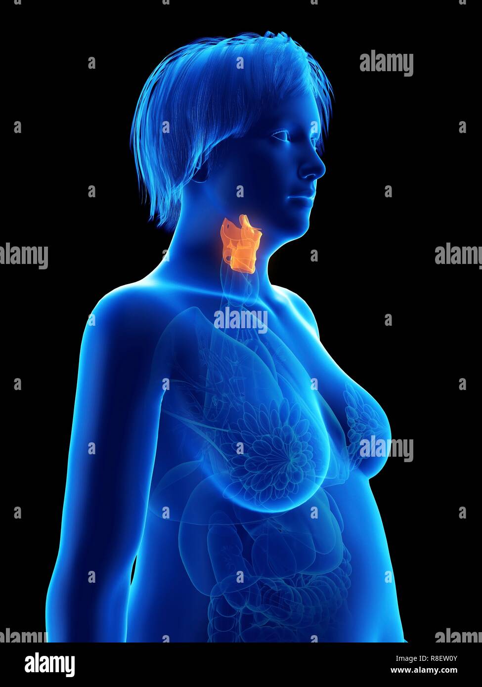 Illustration d'une femme obèse du larynx. Banque D'Images