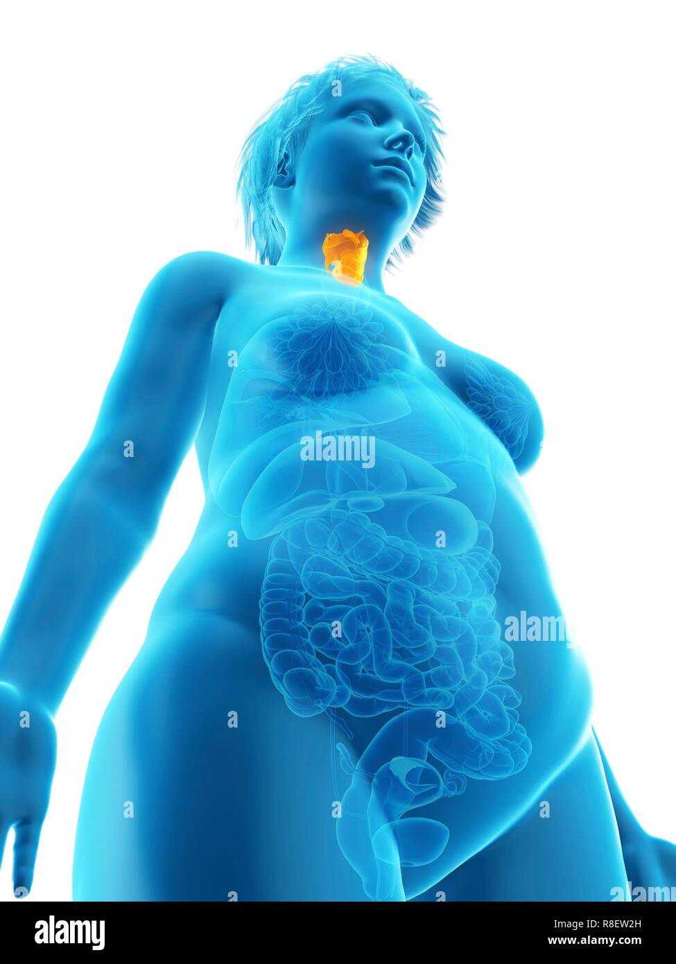 Illustration d'une femme obèse du larynx. Banque D'Images