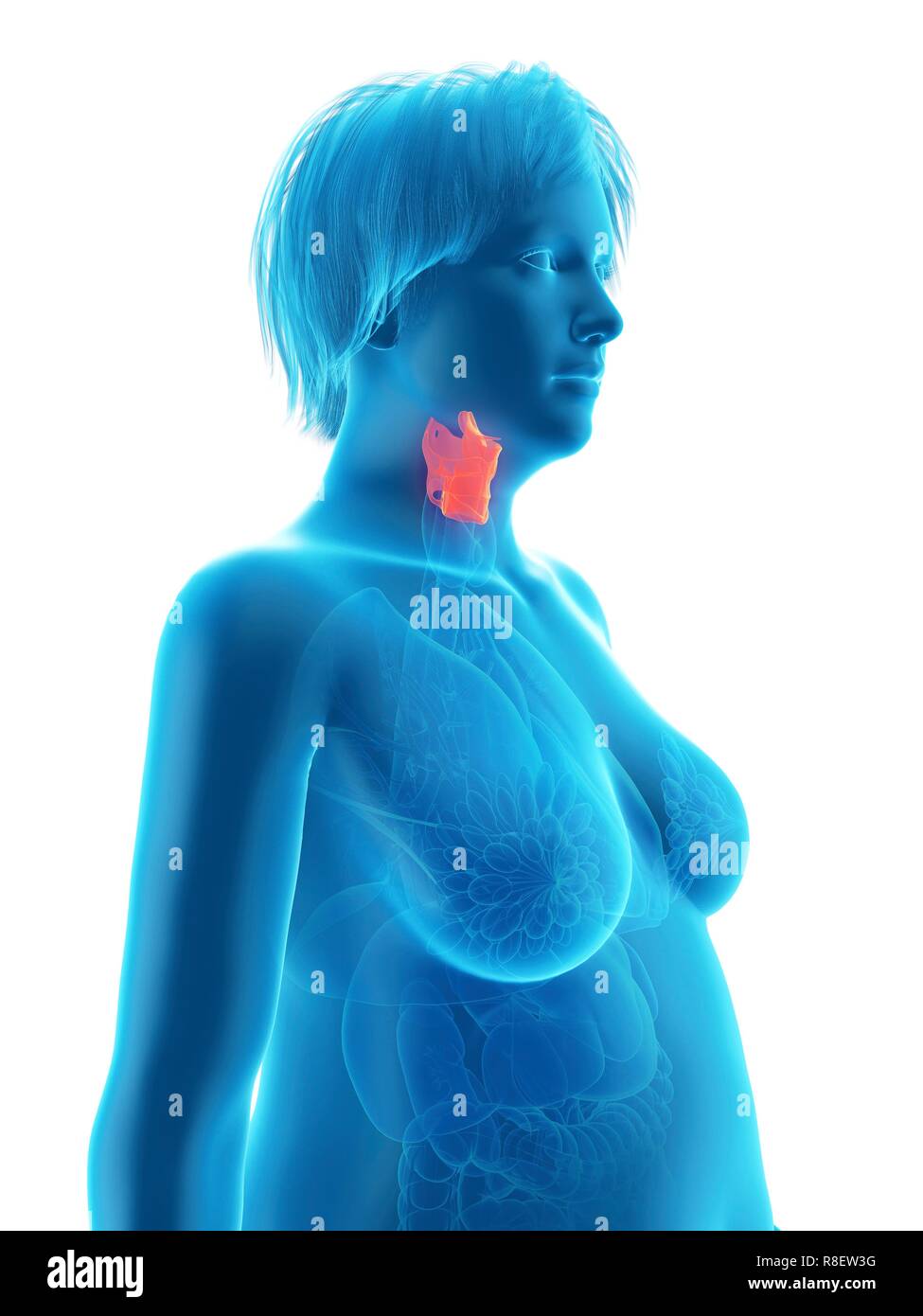 Illustration d'une femme obèse du larynx. Banque D'Images