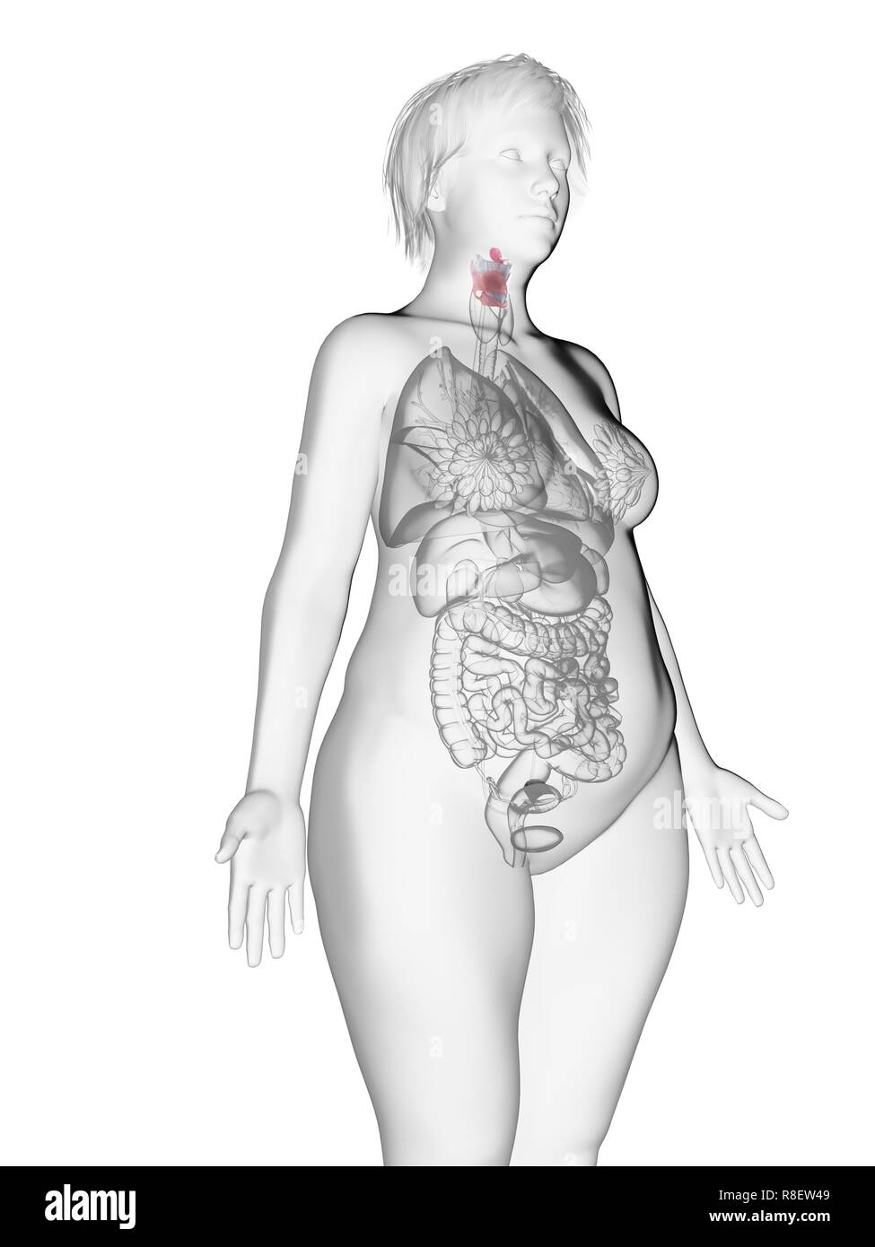 Illustration d'une femme obèse du larynx. Banque D'Images