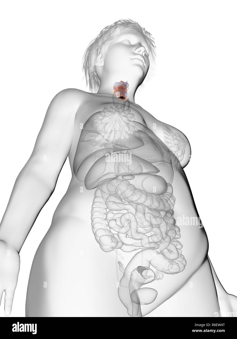 Illustration d'une femme obèse du larynx. Banque D'Images