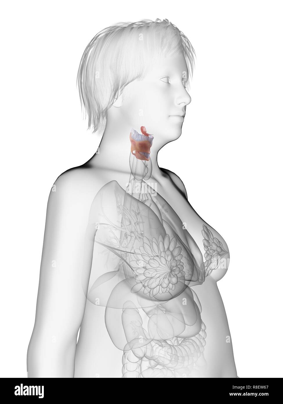 Illustration d'une femme obèse du larynx. Banque D'Images