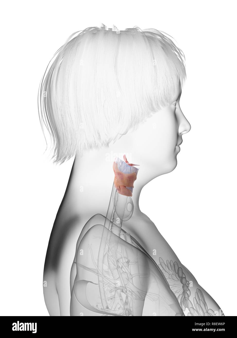 Illustration d'une femme obèse du larynx. Banque D'Images