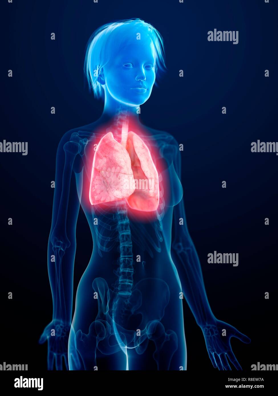 Illustration de l'inflammation de poumon. Banque D'Images