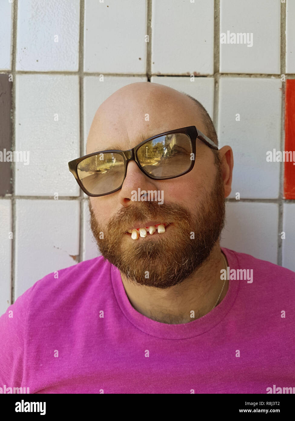 Homme chauve à lunettes avec dents de laid Photo Stock - Alamy