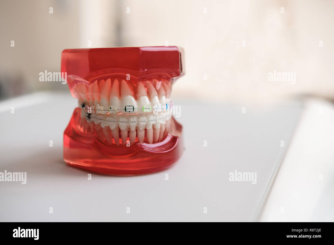 Modèle dentaire mâchoires avec des cales dans le laboratoire de prothèse. La médecine dentaire, l'orthodontie. Close up. Banque D'Images