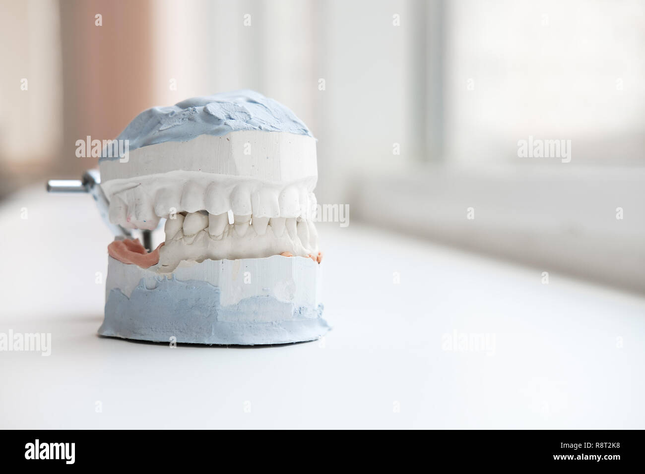 Plâtre de mâchoires. Modèle gypse dentaire mâchoires humaines en laboratoire de prothèse. La médecine dentaire, l'orthodontie. Close up. Banque D'Images