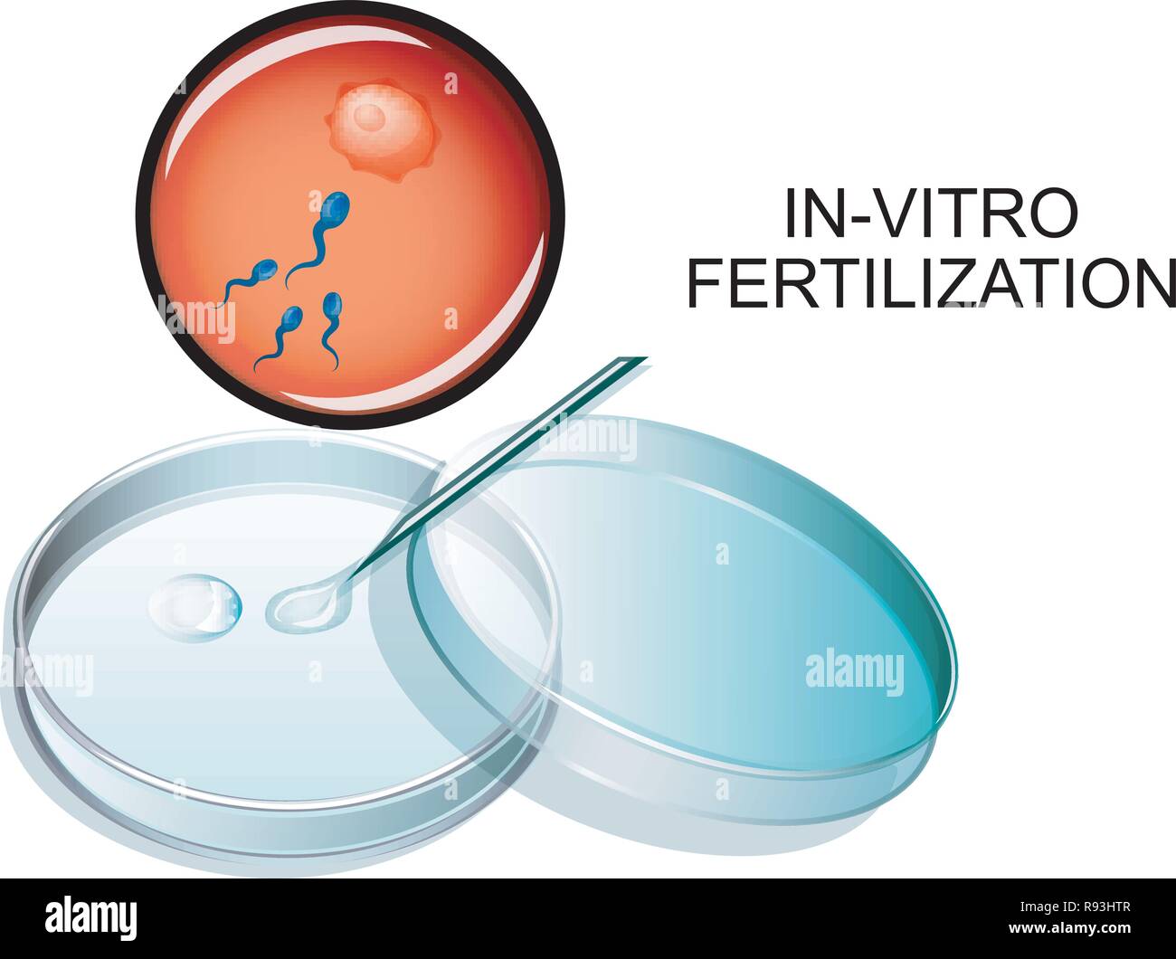 Illustration vecteur de la fertilisation in vitro. La FIV Illustration de Vecteur