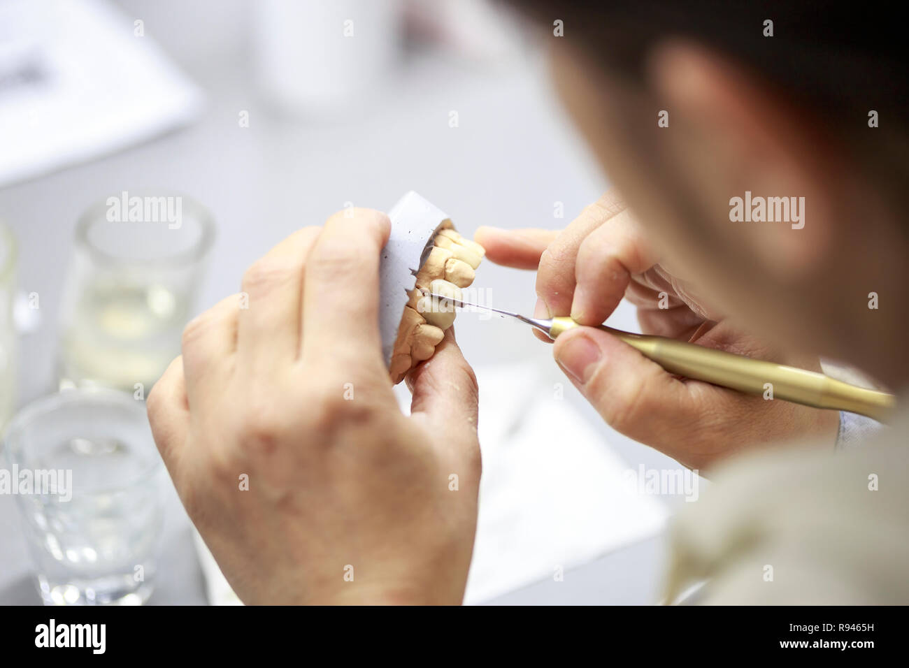 Technicien dentaire travaille sur un moulage dentaire. Main de technicien dentaire travaillant à l'acrylique pour la modélisation de la dent Banque D'Images