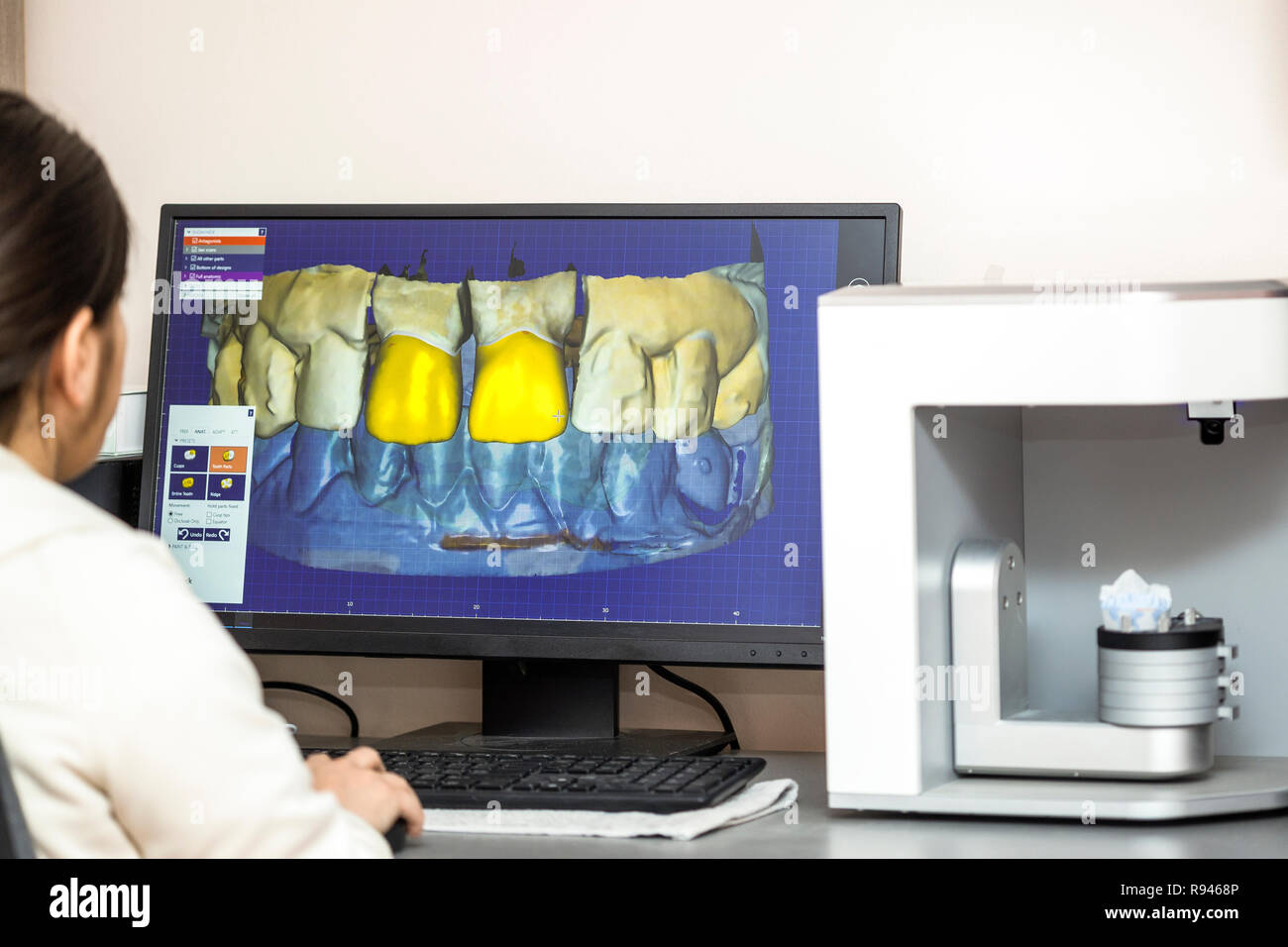 Personne travaillant sur ordinateur avec logiciel dentaire plate-forme pour faire de prothèse dentaire. Processus de fabrication de prothèse dentaire en utilisant un logiciel spécifique. Banque D'Images