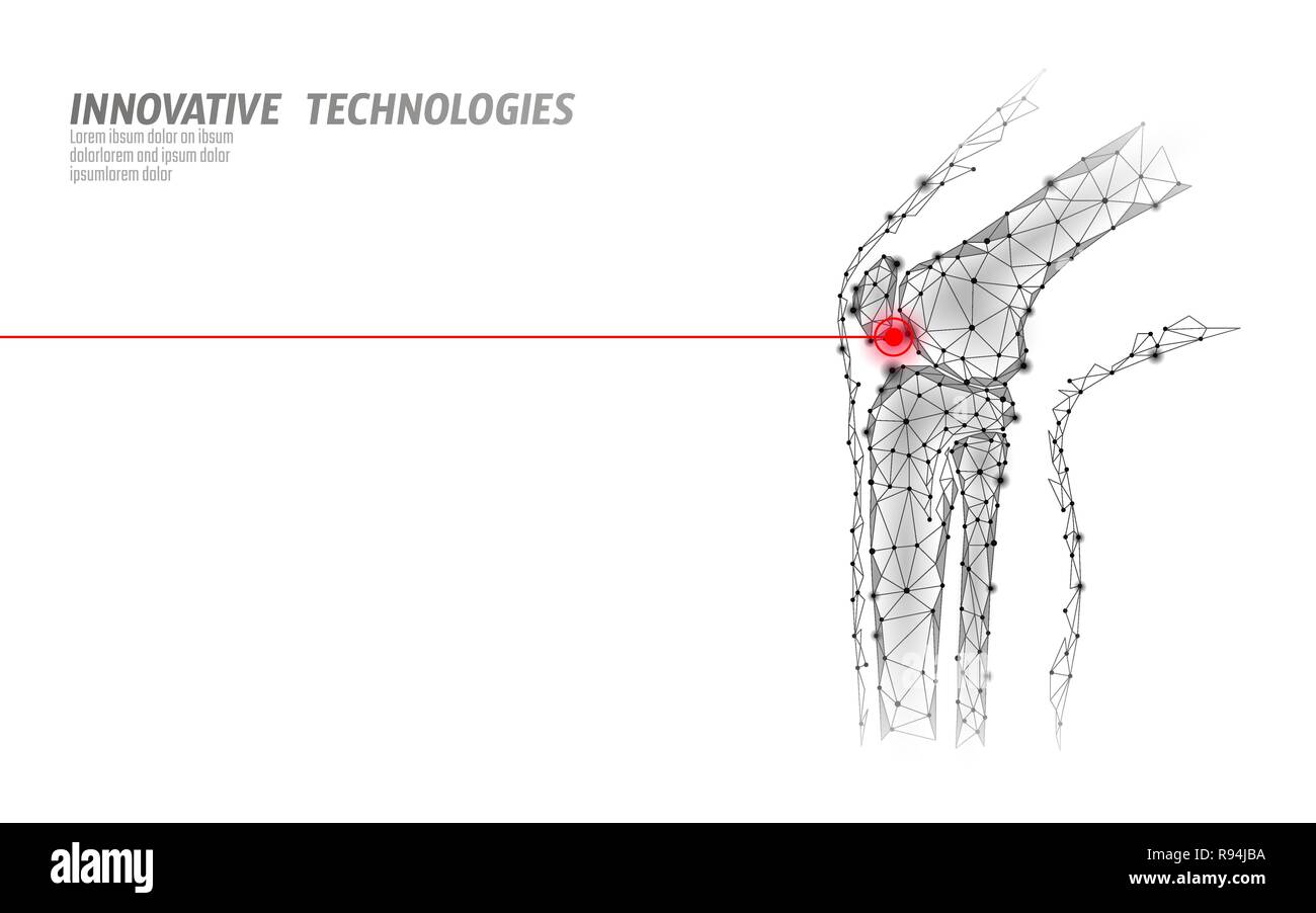 Les droits de l'articulation du genou modèle 3d vector illustration. La technologie de l'avenir design poly basse cure de traitement de la douleur. Fond blanc et rouge homme jambe blessures corps modèle médecine Illustration de Vecteur