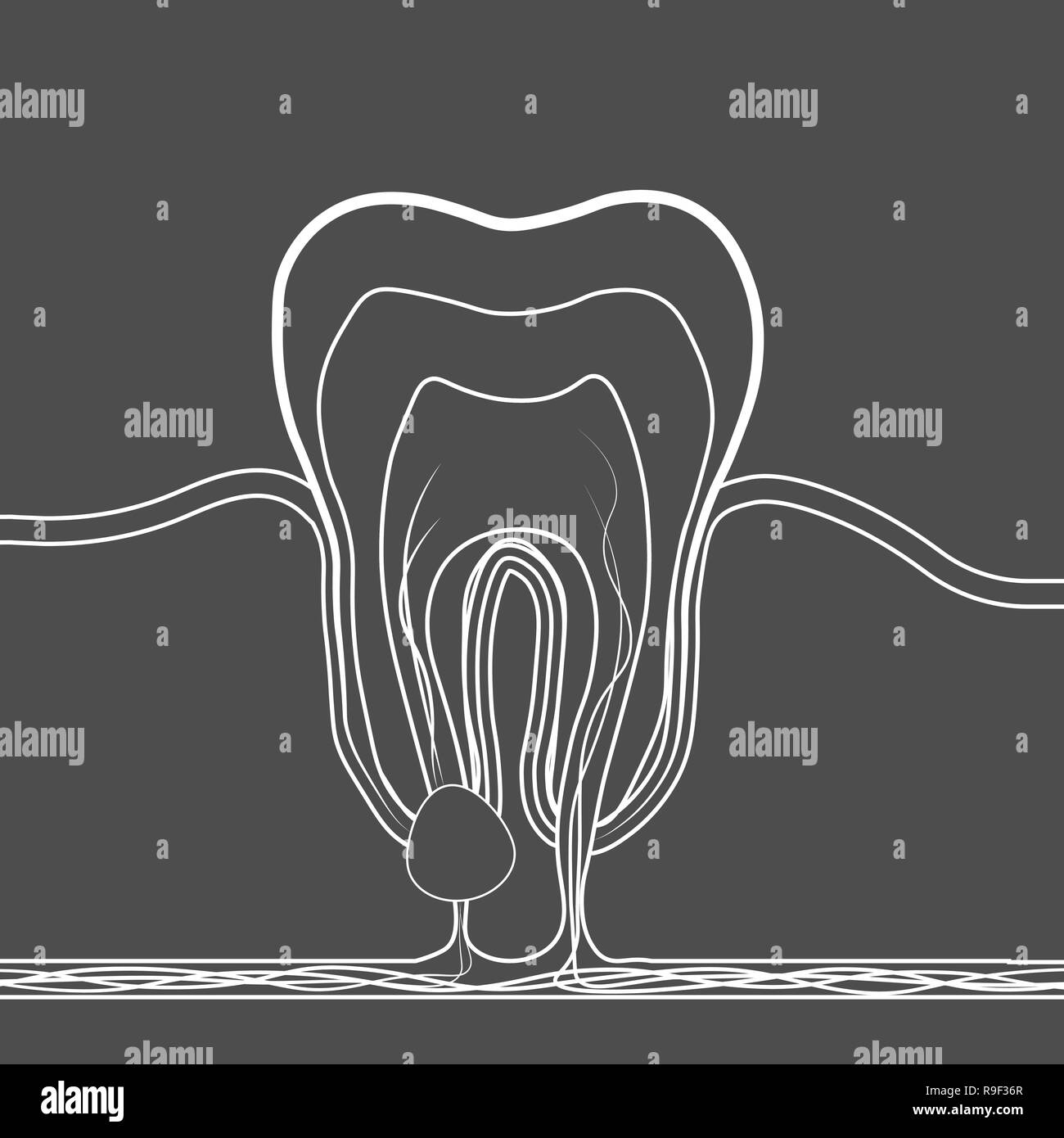 Les maladies dentaires icône linéaire. Illustration médicale de la racine de l'inflammation, de la racine dentaire pulpite kyste,. Eps 10 Illustration de Vecteur