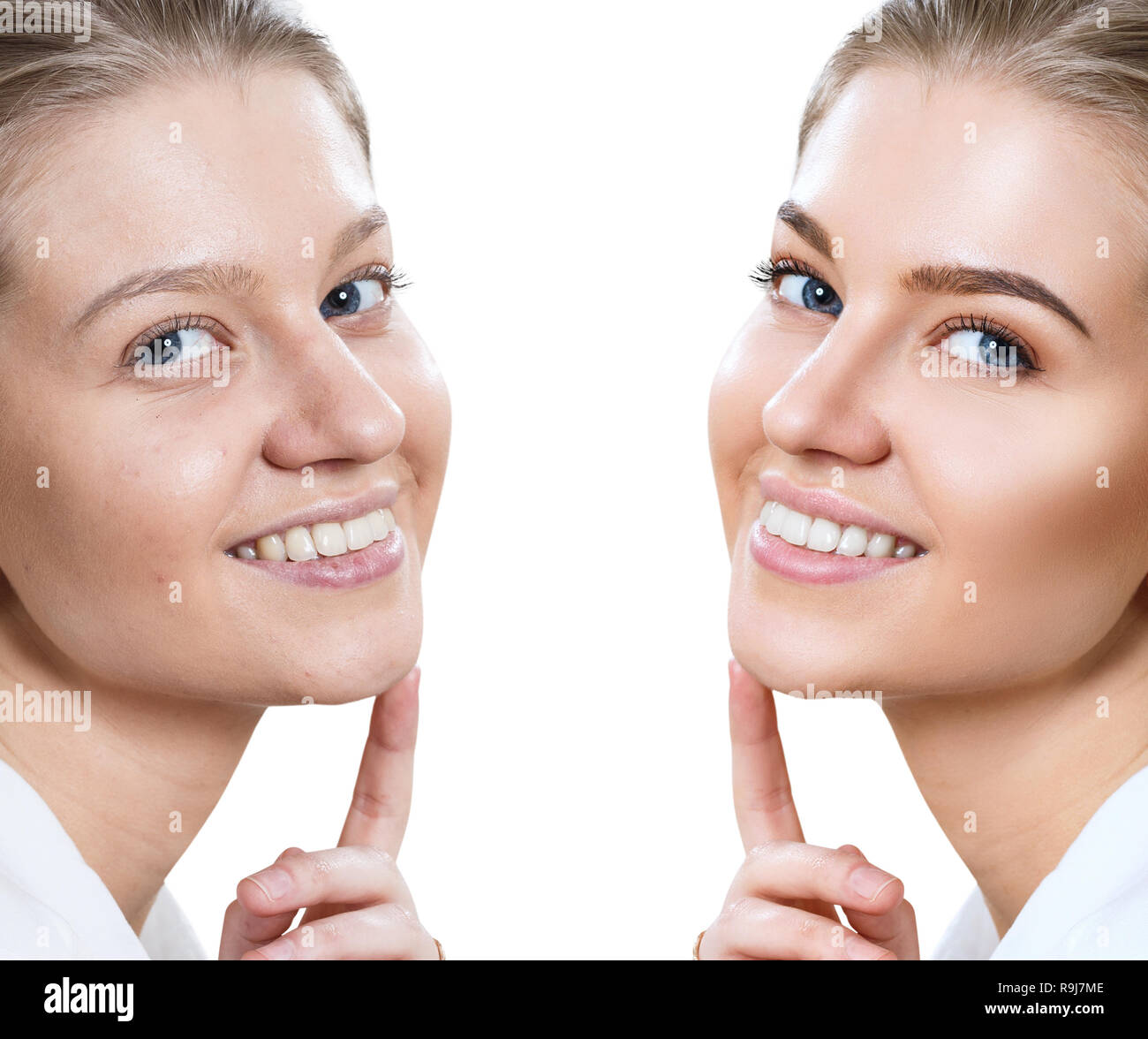 Jeune femme avant et après maquillage sur visage. Banque D'Images
