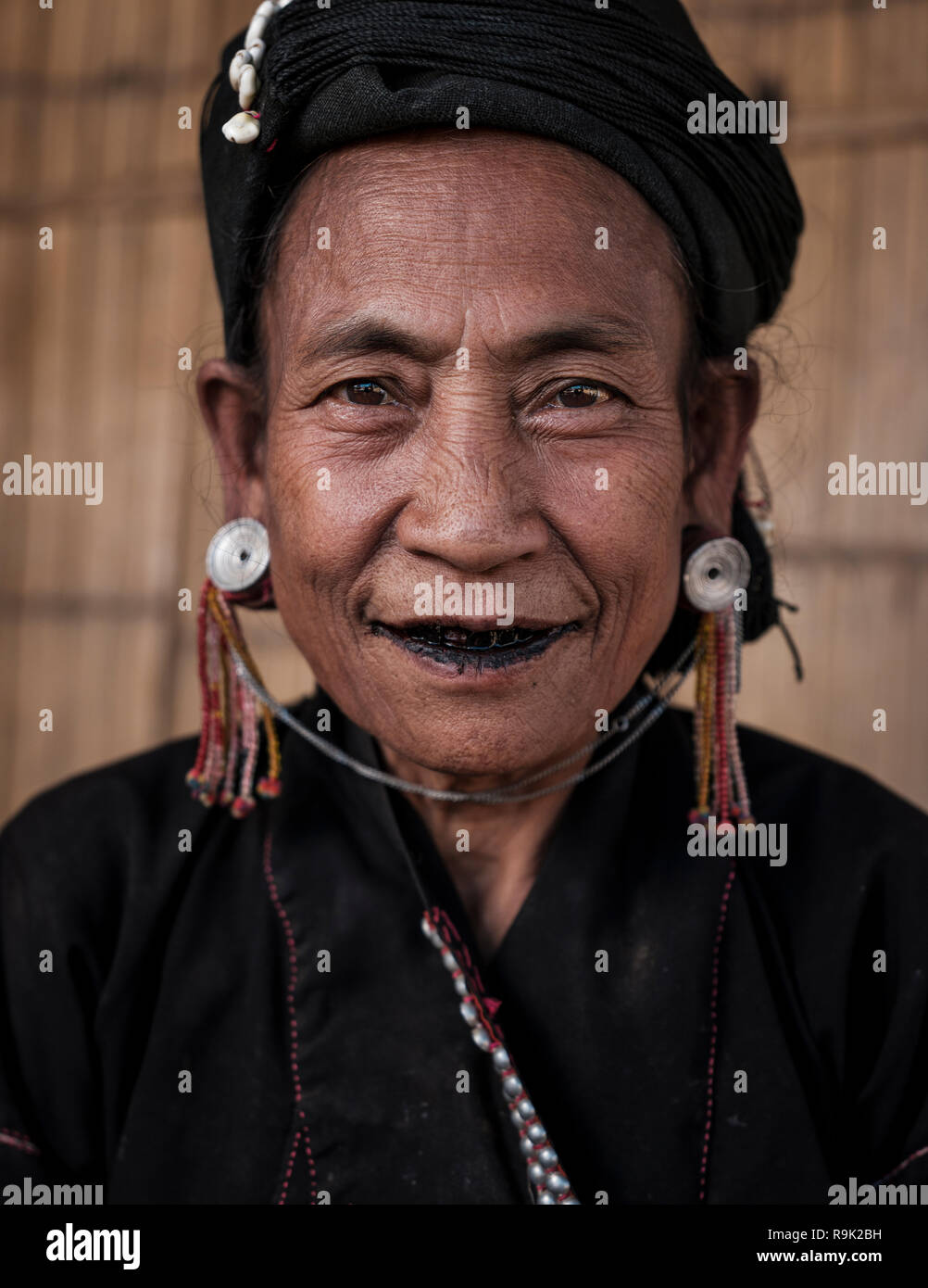 TONG KYAING, MYANMAR - CIRCA DÉCEMBRE 2017 : Portrait d'une femme au Bam Kin Mai Eng. La FRA tribu sont connus pour leurs dents noires. Banque D'Images