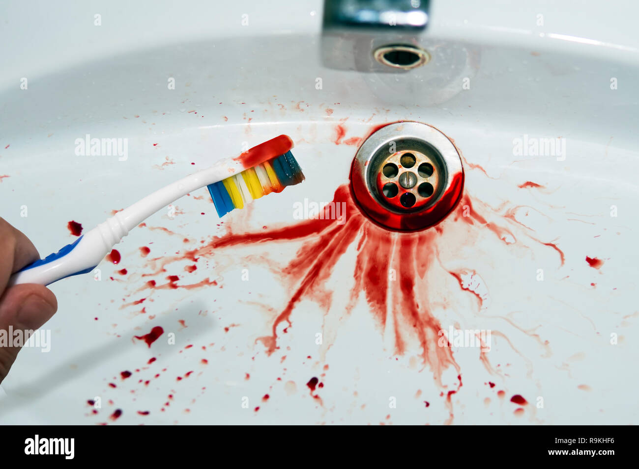 Close up of toothbrush in male main avec des traces de sang sur un fond de puits spitted. Brosse à dents sanglantes près de la vasque. Purge g Banque D'Images