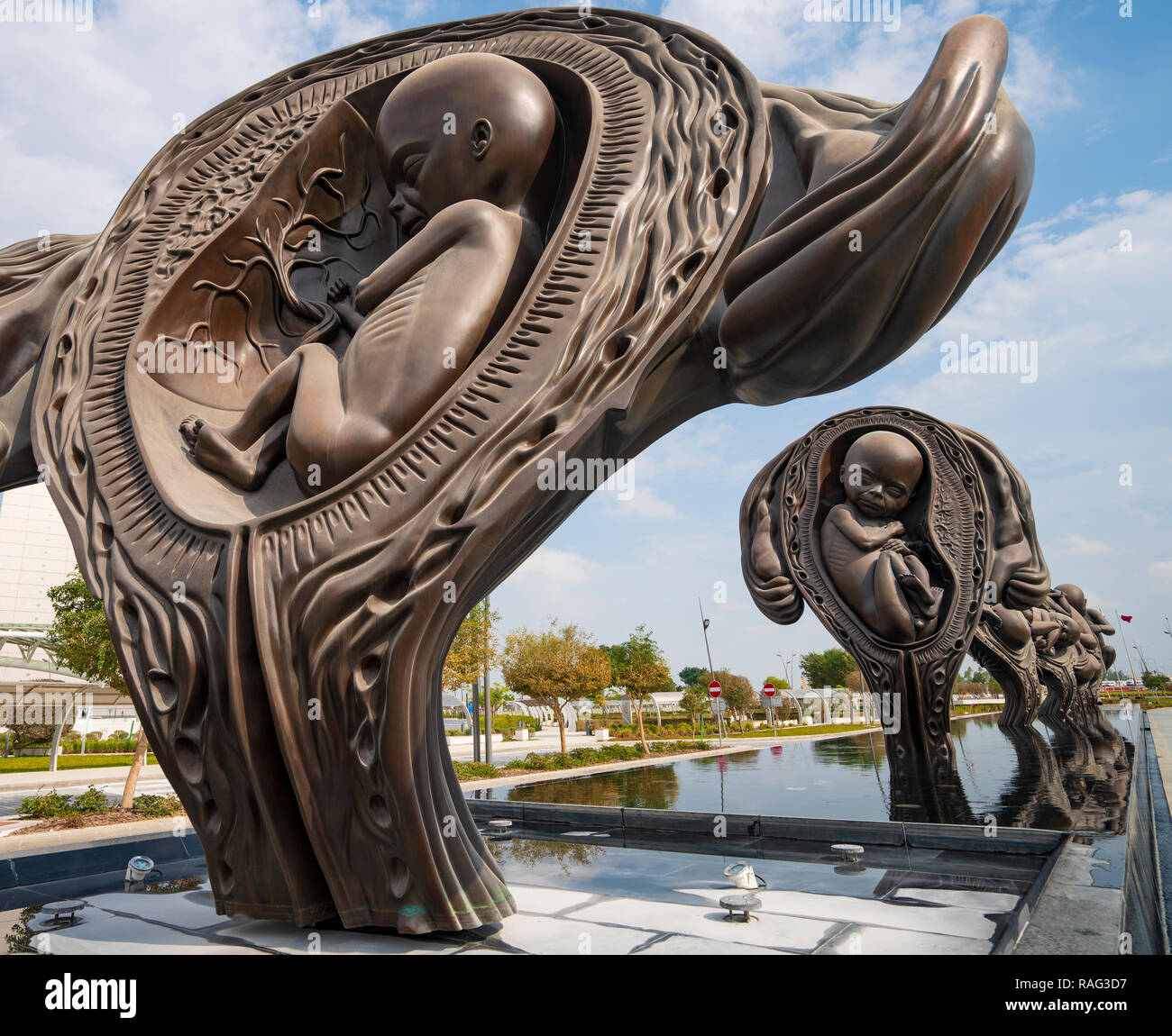 Nouvelles sculptures montrant étapes de l'accouchement dans l'utérus par Damien Hirst à Sidra Hospital à Doha, Qatar Banque D'Images