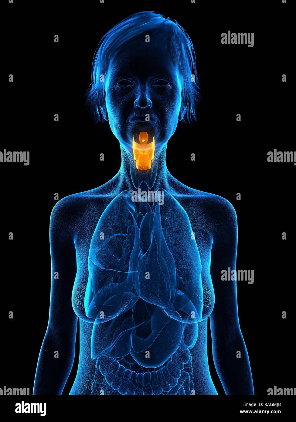Illustration d'une vieille femme de larynx. Banque D'Images