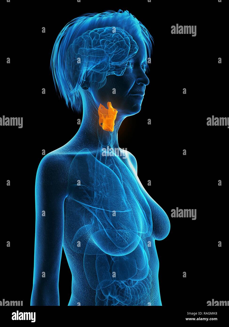 Illustration d'une vieille femme de larynx. Banque D'Images